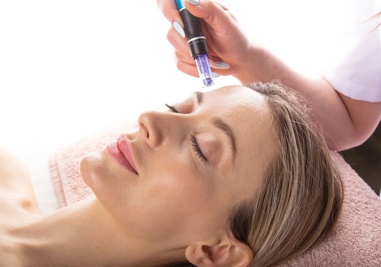 Microneedling